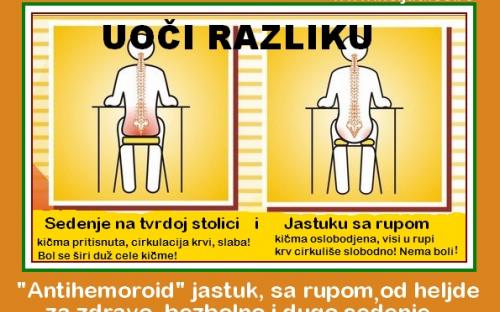 Hemoroidi