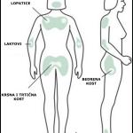 Najkritičnija mesta za dekubitus